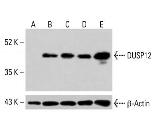 DUSP12 Antibody (H-11) - Western Blotting - Image 415147 