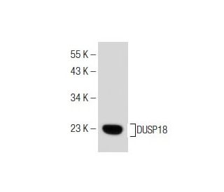DUSP18 Antibody (E-2) - Western Blotting - Image 160600 