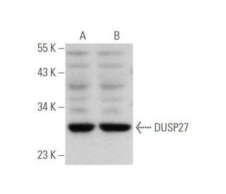 DUSP27 Antibody (F-12) - Western Blotting - Image 349056SAM Transcription Activation: SAM system utilizing dCas9-VP64, MS2-P65-HSF1, and sgRNA for precise gene transcription activation.