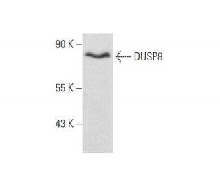 DUSP8 Antibody (B-9) - Western Blotting - Image 131233SAM Transcription Activation: SAM system utilizing dCas9-VP64, MS2-P65-HSF1, and sgRNA for precise gene transcription activation. 