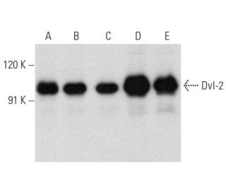 western blotting image from recommended Dvl-2/Dishevelled 2/DVL2 (D-6) monoclonal antibody replacement. Image 358400