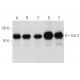 This polyclonal antibody has been discontinued. See our recommended <a href="dvl-2-antibody-d-6">Dvl-2/Dishevelled 2/DVL2 (D-6)</a> monoclonal antibody (sample data shown). western blotting image from recommended Dvl-2/Dishevelled 2/DVL2 (D-6) monoclonal antibody replacement. Image 358400