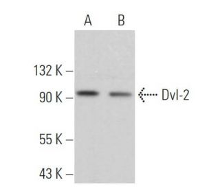 Dvl-2/Dishevelled 2/DVL2 Antibody (10B5) - Western Blotting - Image 361501
