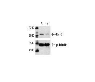 Dvl-2 siRNA (h): sc-35230. Western blot analysis of Dvl-2 expression in non-transfected control (A) and Dvl-2 siRNA transf 