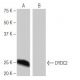 DYDC2 Antibody (9H8) - Western Blotting - Image 64919