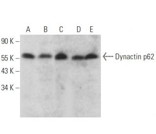 Dynactin p62 Antibody (H-12) - Western Blotting - Image 359317 