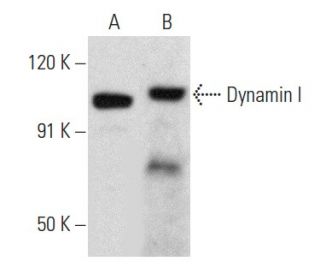 Dynamin I Antibody (4E67) - Western Blotting - Image 356935 
