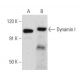 Dynamin I Antibody (4E67) - Western Blotting - Image 356935 
