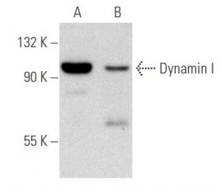 Dynamin I Antibody (4E67) - Western Blotting - Image 356593 