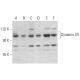Dynamin I/II Antibody (E-4) - Western Blotting - Image 354555 