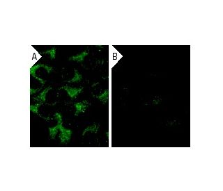 Dynamin II siRNA (h): sc-35236. Immunofluorescence staining of methanol-fixed, control HeLa (A) and Dynamin II siRNA silen 