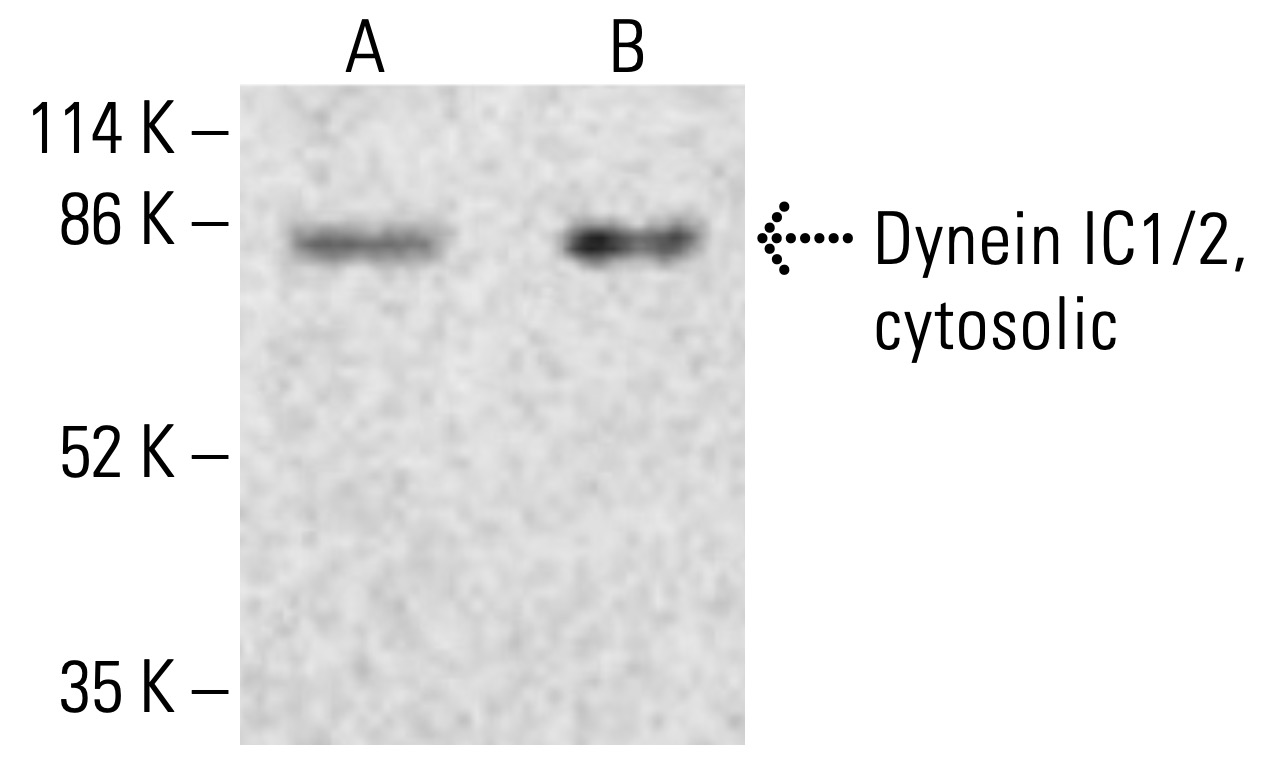 Dynein IC1/2, cytosolic Antibody (74-1) | SCBT - Santa Cruz