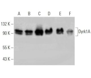 western blotting image from recommended Dyrk1A (RR.7) monoclonal antibody replacement. Image 368221