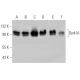 Este anticuerpo policlonal ha dejado de fabricarse. Consulta nuestro anticuerpo monoclonal recomendado <a href="dyrk1a-antibody-rr-7">Dyrk1A (RR.7)</a> (se muestran datos de muestra). western blotting image from recommended Dyrk1A (RR.7) monoclonal antibody replacement. Image 368221