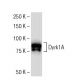Dyrk1A Antibody (RR.7) - Western Blotting - Image 33753 