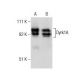 Dyrk1A Antibody (RR.7) - Western Blotting - Image 160458