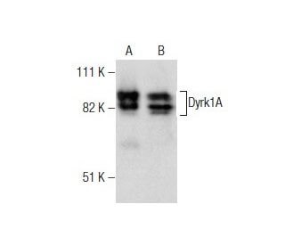 Dyrk1A Antibody (RR.7) - Western Blotting - Image 160458