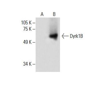 Dyrk1B Antibody (H-6) - Western Blotting - Image 288290 