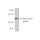 Dyrk2 Antibody (6E2) - Western Blotting - Image 348965