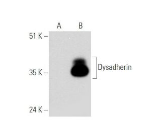 Dysadherin Antibody (A-4) - Western Blotting - Image 344514