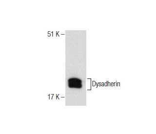 Dysadherin Antibody (D-10) - Western Blotting - Image 281830 
