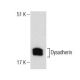 Dysadherin Antibody (D-10) - Western Blotting - Image 281830 