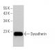 Dysadherin Antibody (D-10) - Western Blotting - Image 369335