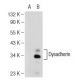 Dysadherin Antibody (D-2) - Western Blotting - Image 108885