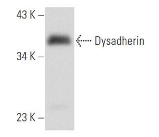 Dysadherin Antibody (D-2) - Western Blotting - Image 356906 
