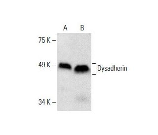 Dysadherin Antibody (G-6) - Western Blotting - Image 287911