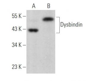 Dysbindin Antibody (B-5) - Western Blotting - Image 363843 