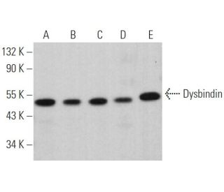 Dysbindin Antibody (D-8) - Western Blotting - Image 363844 