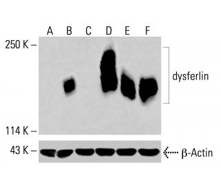 dysferlin Antibody (C-11) - Western Blotting - Image 415574 