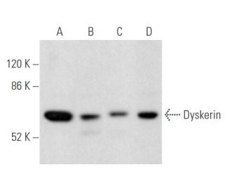 Dyskerin Antibody (C-11) - Western Blotting - Image 355524 