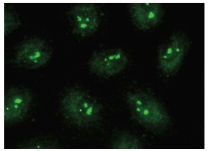 AntiDyskerin Antibody (H3) SCBT Santa Cruz Biotechnology
