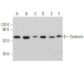 Dyskerin Antibody (H-3) - Western Blotting - Image 359726