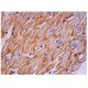 immunohistochemistry image from recommended dystrophin (MANDRA1) monoclonal antibody replacement. Image 290458