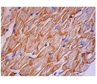 immunohistochemistry image from recommended dystrophin (MANDRA1) monoclonal antibody replacement. Image 290458