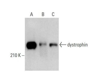 dystrophin Antibody (4C7) - Western Blotting - Image 378740