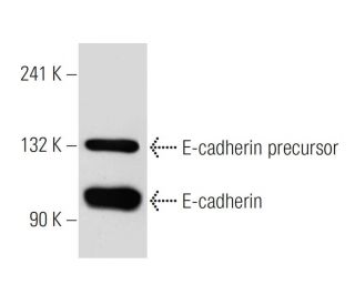 E-cadherin Antibody (5H9) - Western Blotting - Image 38452