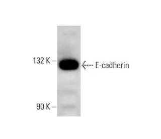 E-cadherin Antibody (67A4) - Western Blotting - Image 348906 