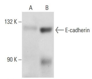 E-cadherin Antibody (6F9) - Western Blotting - Image 18362