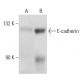E-cadherin Antibody (6F9) - Western Blotting - Image 18362