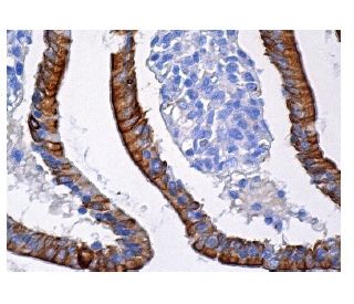 E-cadherin Antibody (DECMA-1) - Immunohistochemistry - Image 157180 