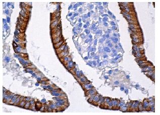 E-cadherin Antibody (DECMA-1) | SCBT - Santa Cruz Biotechnology