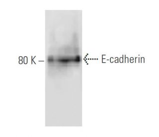 E-cadherin Antibody (Sec11) - Western Blotting - Image 137492