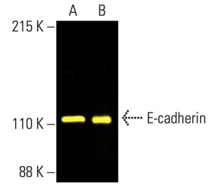 E-cadherin Antibody (67A4) - Western Blotting - Image 402233