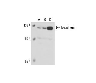 E-cadherin Antibody (1.B.54) - Western Blotting - Image 17551