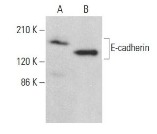 E-cadherin Antibody (DECMA-1) - Western Blotting - Image 379644The Double Nickase Plasmid features a U6 promoter for sgRNA expression, a 20 nt targeting sequence, and a gRNA scaffold to guide Cas9n. It includes a CBh promoter for Cas9n (D10A) and puromycin resistance, GFP for transfection verification, and nuclear localization signals (NLS). The 2A peptide allows co-expression of Cas9n and Puro from a single promoter, enabling precise genome editing with reduced off-target effects. 