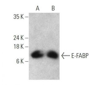 E-FABP Antibody (B-3) - Western Blotting - Image 358619 